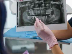 親知らずは抜くべき？抜歯が必要なケースと不要なケース